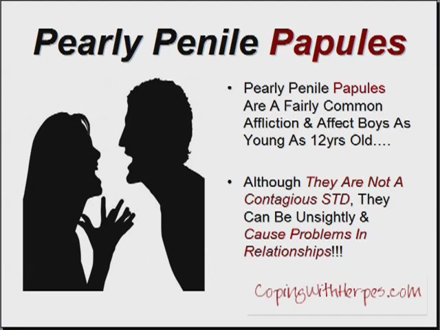 Pearly penile papules wiki